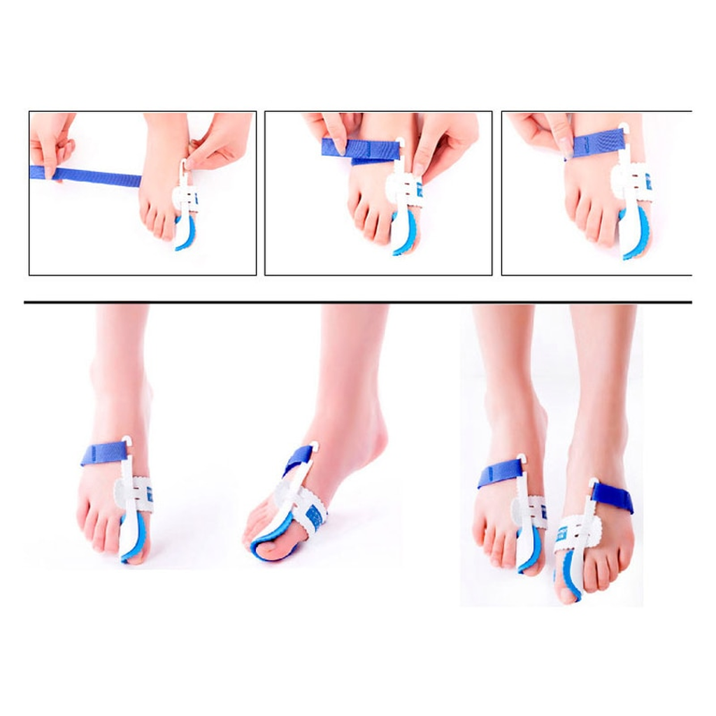 Bunion Corrector